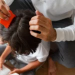 Infographic comparing government health workers' roles in lice prevention programs