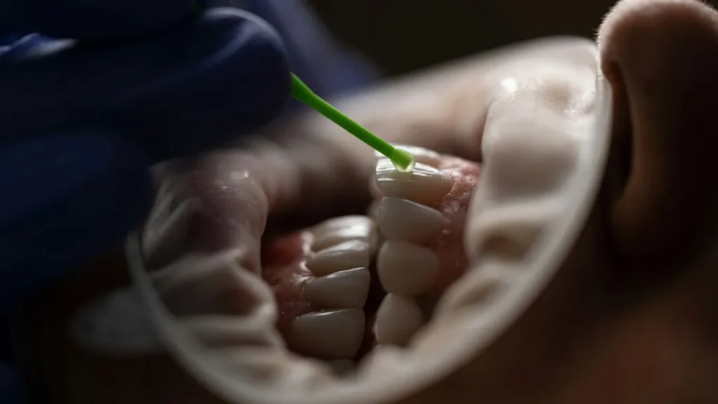 how to cure gum disease without a dentist a complete guide