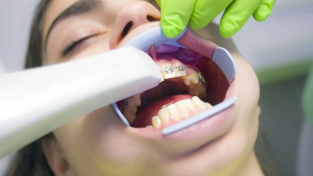 the best guide on how to cure gum disease without a dentist